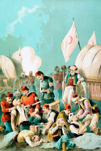 Amputazione di un braccio senza anestesia, Guerra russo-turca, 1877 da Unbekannt
