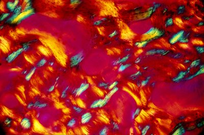 Biomateriali, osso LM da Unbekannt