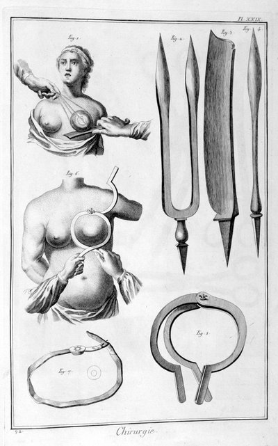 Chirurgia al seno, 1751-1777 da Unbekannt