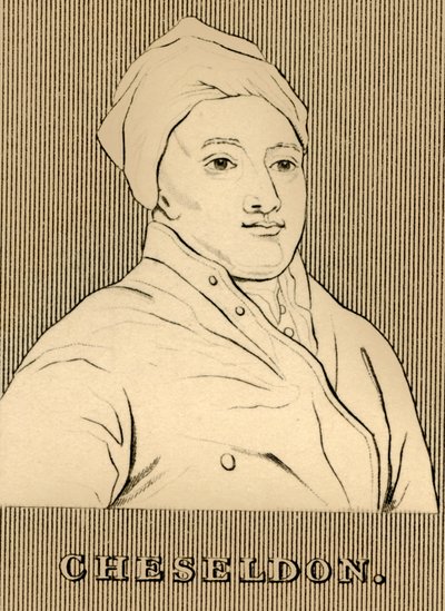 Cheseldon, 1688-1752, 1830 da Unbekannt