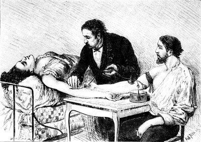 Il dottor Roussell di Ginevra che effettua una trasfusione diretta di sangue a una donna da un volontario, 1882 da Unbekannt