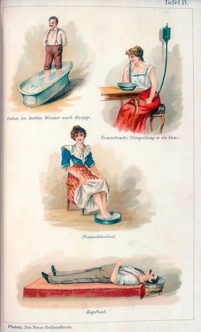 Trattamenti di idroterapia, c1902 da Unbekannt