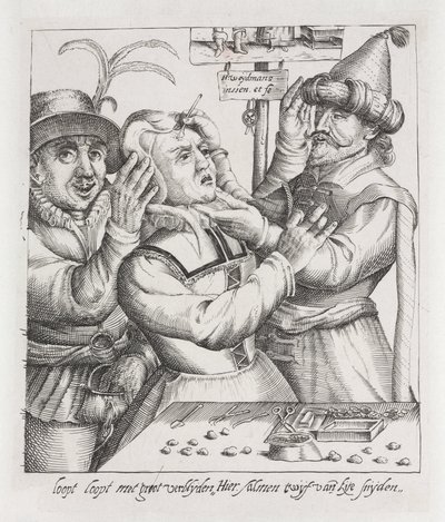 Trepanazione ïRimozione della pietra, incisione da Unbekannt