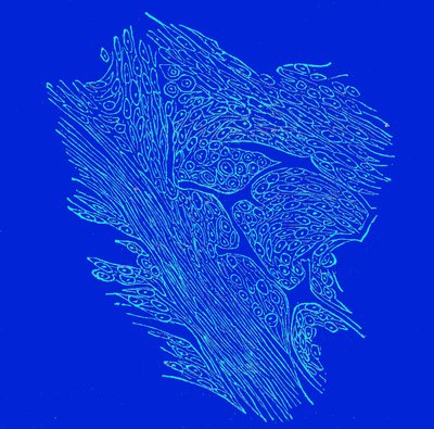 Sezione trasversale di tumori fibro-nucleati da Unbekannter Künstler