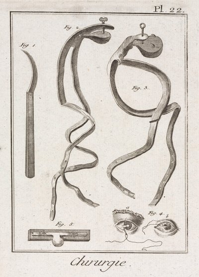 Chirurgia oculare dell