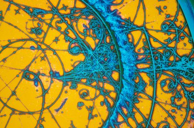 Bronzo alluminio, micrografia a luce da Unbekannt