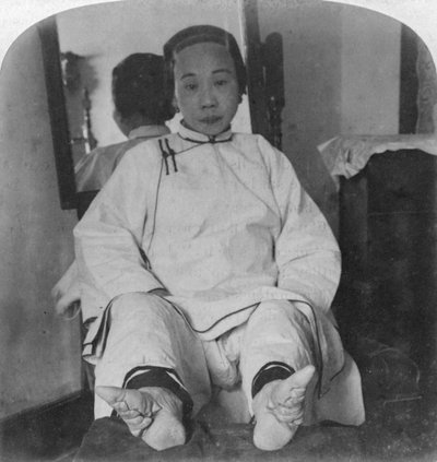 I delicati piedi di una signora di alta casta, mostrando il metodo di deformità, Cina, 1900 da Underwood and Underwood