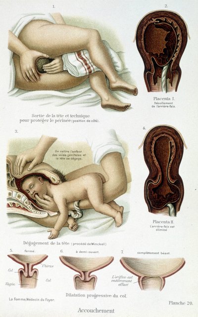 Parto - tavola scientifica, fine XIX secolo da Unknown artist