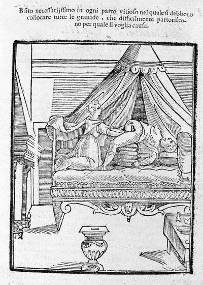 Scena di parto dopo "Della Commare" di Scipione Mercuri da Unknown artist
