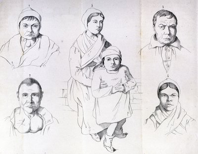 Considerazioni sulle cause del cretinismo endemico di Morel da Unknown artist