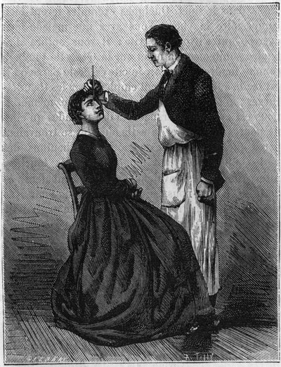 Fenomeni di ipnotismo: ipnotismo prodotto fissando un portamatite posto tra gli occhi. Incisione del 1881. da Unknown artist