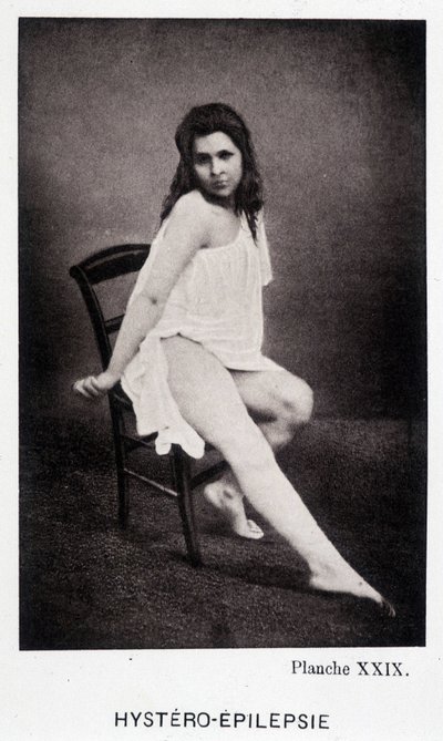 Hystero Epilepsie - Contrattura in "Iconografia fotografica della Salpêtrière: servizio del Sig. Charcot" di Paul Regnard e Bourneville da Unknown artist