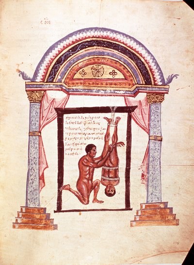 Medicina: riduzione di un ginocchio dislocato, il paziente è sospeso per i piedi (manoscritto) da Unknown artist