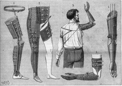 Apparecchi moderni per amputati. 1) gamba artificiale con cintura, 2) apparecchio per disarticolare la coscia, 3 e 4 braccia artificiali inventate e costruite da M.L Matthieu per il defunto Roger, 5) braccio artificiale con mano, pollice e indice. in 