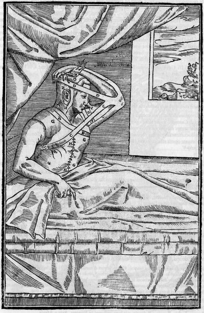 Chirurgia del naso: Chirurgia ricostruttiva del naso in "De curtorum chirurgia per insitionem". Venezia da Unknown artist