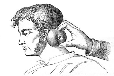 Salassi locali - applicazione di sanguisughe con una mela - incisione in "La Santé Universelle - Guide Médical des Familles" 1852 da Unknown artist