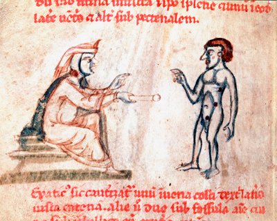 Il medico brucia il paziente nelle aree dolorose con ferri caldi, miniatura dal manoscritto De Medicina cauteriorum secundum Brunum, Rugerium et Rolthe, XIII secolo, Parigi, B.N. da Unknown artist