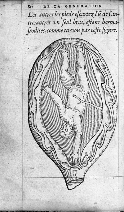 La posizione del feto nell