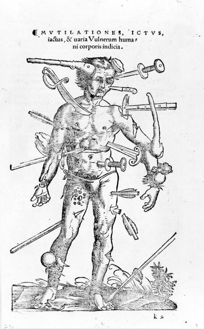 Tutti i tipi di ferite traumatiche di guerra. XVI secolo da Unknown artist