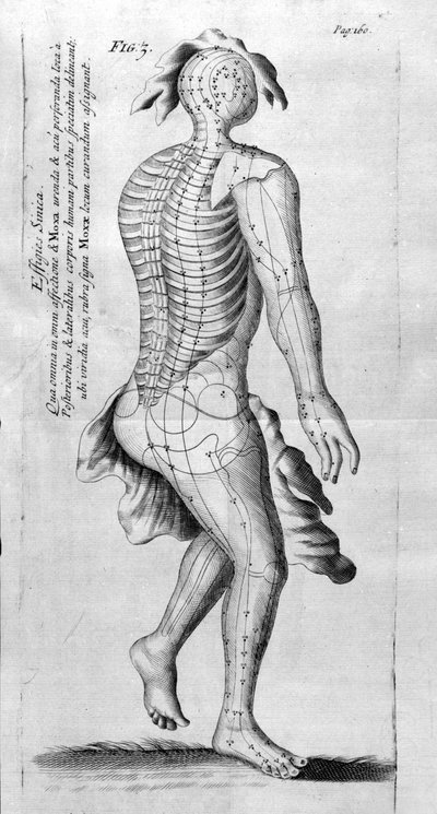 De Acupunctura di W.Ten Rhijne. Londra 1683. Primo testo occidentale sull