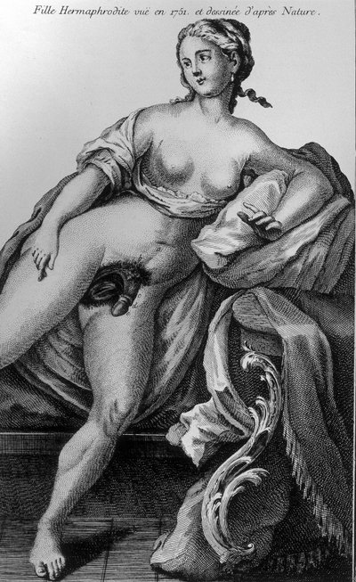 Ragazza ermafrodita vista nel 1751 e disegnata dal vivo da Unknown artist