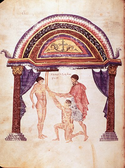 Medicina: riduzione di un gomito lussato, il paziente è appeso per il braccio (manoscritto) da Unknown artist