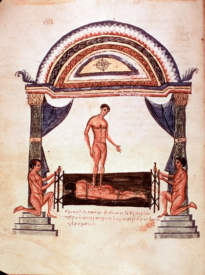 Medicina: riduzione di una colonna vertebrale lussata - il paziente è fissato su una tavola di legno, uno dei terapeuti sta sulla sua schiena (manoscritto) da Unknown artist