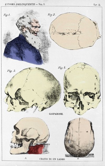 Studio sulla morfologia di un cranio delinquente da parte del criminologo italiano da Unknown artist