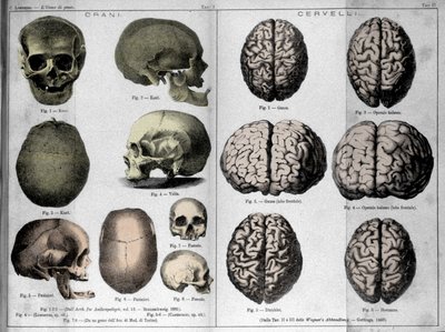 Le pelli e i cervelli degli uomini di genio. Studio di Cesare Lombroso (1835-1909), criminologo italiano in L