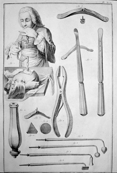 Trepanazione del cranio, vari strumenti da Unknown artist