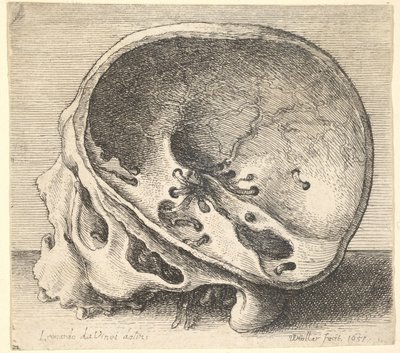 Teschio sezionato in profilo a sinistra con il lato sinistro del cranio rimosso, 1651 da Wenceslaus Hollar