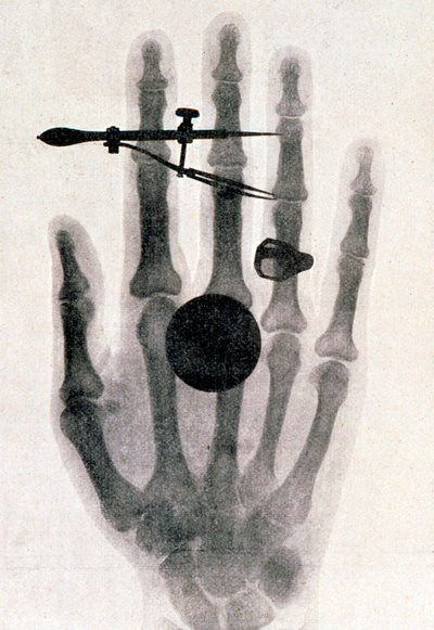 Radiografia della mano della moglie di Wilhelm Roentgen, 1896 da Wilhelm Conrad Rontgen