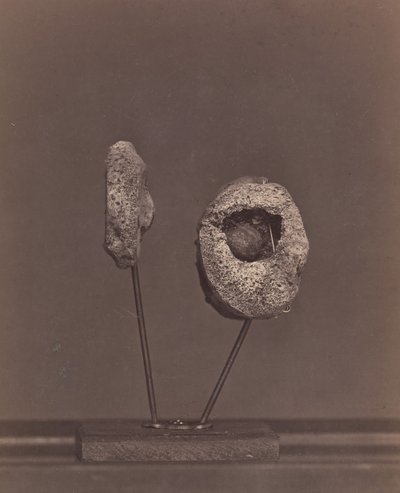 Articolazione del ginocchio escissa. Una palla di moschetto rotonda nel condilo interno del femore destro da William H. Bell