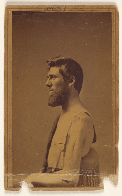 [Vittima della guerra civile non identificata di profilo, seduta]. da William H. Bell