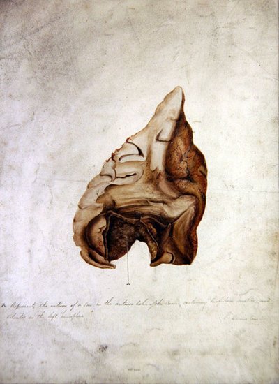 Studio del cervello I, c.1850 da William Lover