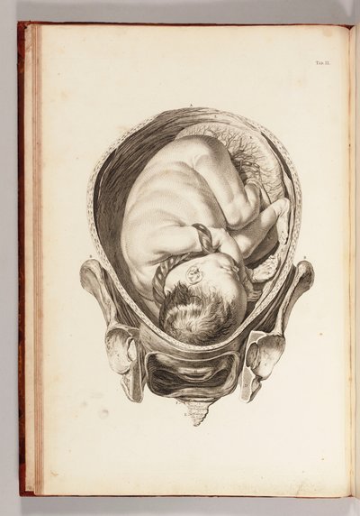 Incisione di un bambino nel grembo materno da "Una serie di tavole anatomiche, con spiegazioni e un compendio della pratica dell