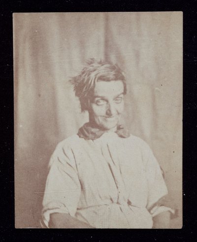Ritratto psichiatrico di un paziente, Surrey County Asylum, c. 1852 da John Pardon