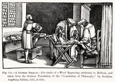 Un chirurgo tedesco, da Consolation of Philosophy di Boethius, illustrazione da Science and Literature in the Middle Ages and Renaissance, scritto e inciso da Paul Lacroix, 1878 da after German School
