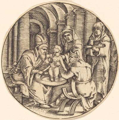La circoncisione da after Master IB