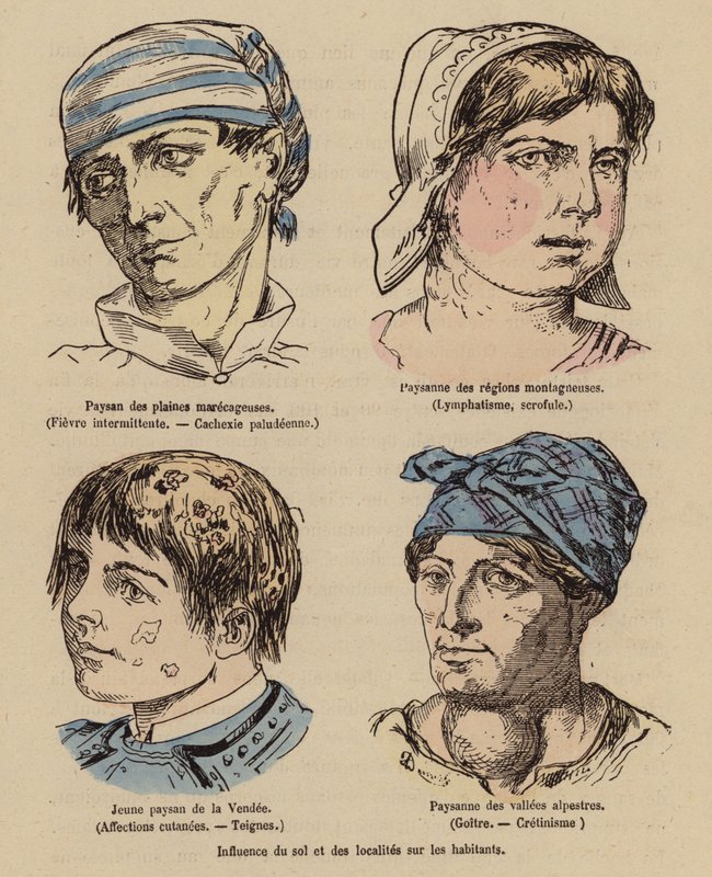 Influenza del sole e della posizione geografica sulle persone da (after) French School
