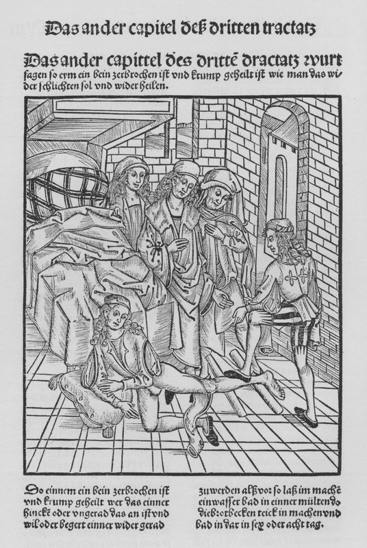 Il libro di Cirurgia di Hieronymus Brunschwig da (after) German School