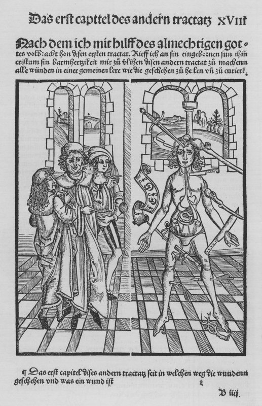 Il libro di Cirurgia di Hieronymus Brunschwig da (after) German School