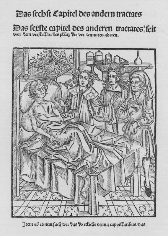 Il libro di Cirurgia di Hieronymus Brunschwig (litografia) da (after) German School