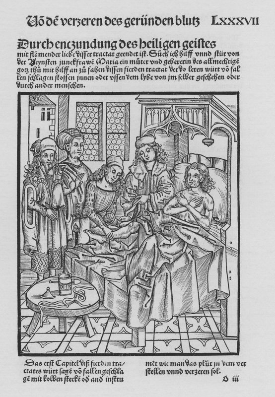Il libro di Cirurgia di Hieronymus Brunschwig da (after) German School