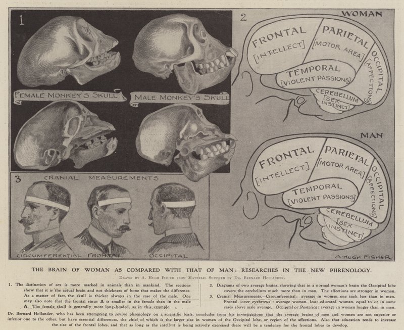 Il cervello della donna rispetto a quello dell