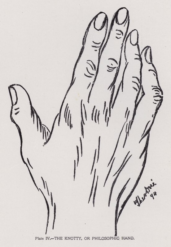 La mano nodosa o filosofica da English Photographer