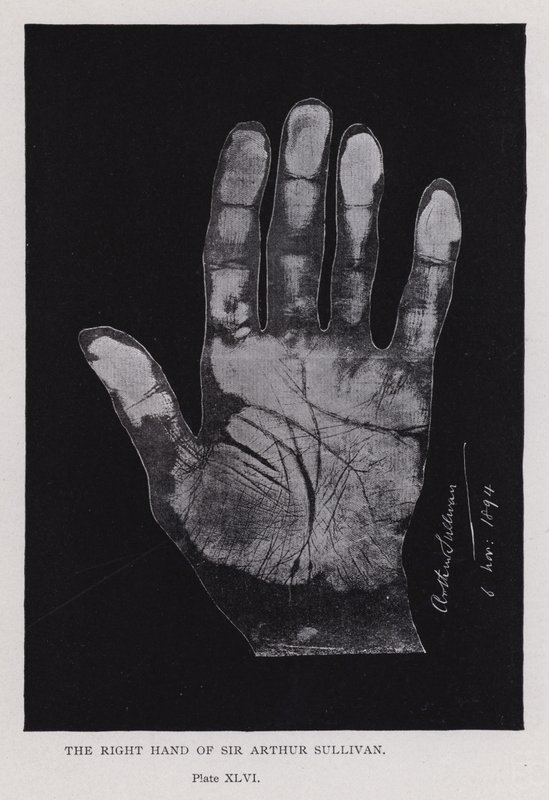 La mano destra di Sir Arthur Sullivan da English Photographer
