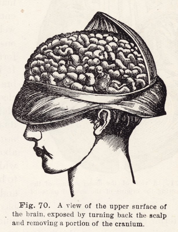 Vista della superficie superiore del cervello, esposta sollevando il cuoio capelluto e rimuovendo una parte del cranio (incisione) da English School