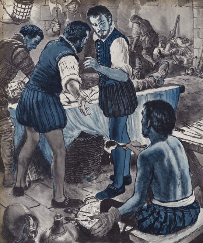 Ambroise Paré, chirurgo militare, quando l