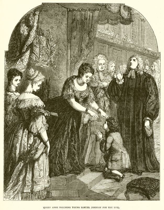 La Regina Anna tocca il giovane Samuel Johnson per il male da English School